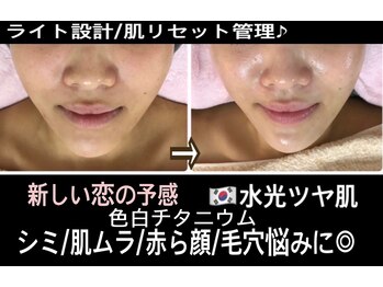 アルページュ(Arpege)/肌改善リフト！リセット管理♪