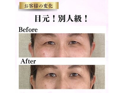 ドロップ(Drop)の写真