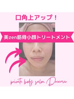 ドリーマー(Dreamer)/口角アップで小顔に!