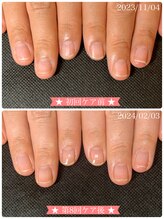 ネイルサロン ベルエトワール(belle etoile)/美爪育成ネイルケア3ヶ月コース