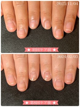 ネイルサロン ベルエトワール(belle etoile)/美爪育成ネイルケア3ヶ月コース
