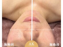 エーケーエステティックス 福山店(AK Esthetics)