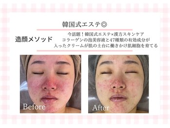 アルゴ 熊本玉名店(ALGO)/韓国式エステ