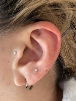 トナリ鍼灸院/耳ツボジュエリー