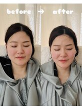 ティアラ(tiara)/小顔ハーブ蒸し