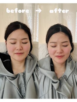 ティアラ(tiara)/小顔ハーブ蒸し