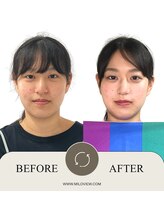 ミラビュー(MILOVIEW)/”似合う”がわかるト-タルsalon