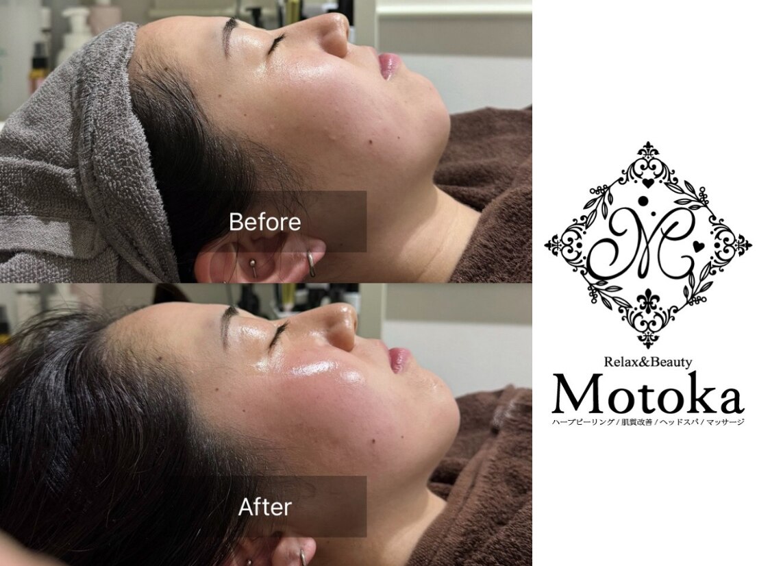 リラックスアンドビューティー モトカ(Motoka)｜ホットペッパー
