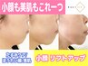 【30代/40代から始める小顔リフト】75%OFF!!4,950円☆たるみ改善小顔ケア