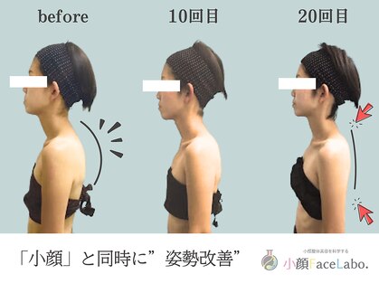 小顔フェイスラボ 難波店(小顔 Face Labo)の写真