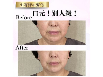 ドロップ(Drop)の写真
