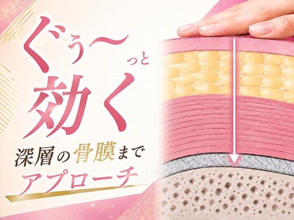 ソレア(Solea)の写真
