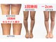 イネレ(INNE)の写真