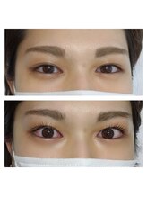 メゾン ルマ(Maison Luma)/パリジェンヌラッシュリフト