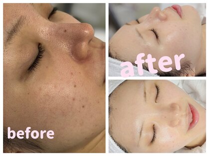 オカオビューティー 枚方市駅前南口店(okao beauty)の写真