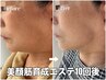 【終了間近！】【美顔筋育成エステで小顔矯正】1ヵ月以内ご予約¥19800→¥8800