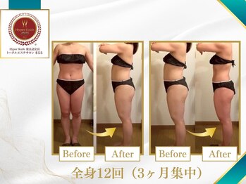 まるる/最新痩身★ハイパーナイフ7痩身