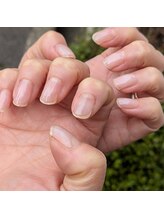 マッシュルーム グロウス(MUSHROOM GROWTH)/育爪クリア