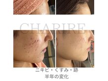 シェリル 出雲店(CHARIRE)