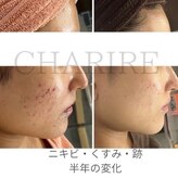 シェリル 出雲店(CHARIRE)