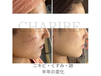 シェリル 出雲店(CHARIRE)