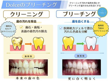 ドルチェ(Dolce)の写真