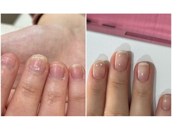 爪家の写真/【爪のコンプレックスを解消】短い・薄い等のお悩みも丁寧なケアで美爪に◎毎日眺めたくなる綺麗な手元に☆