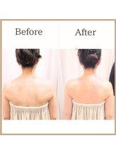 サロンルーチェ(Salon Luce)/50代ビフォーアフター/施術6回