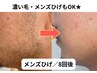 【メンズ】顔全体…4980円→3980円