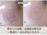 【都度払い】高濃度炭酸肌改善フェイシャル 120分