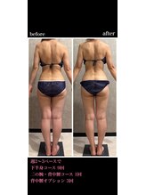 トータルビューティー ミミ(Total Beauty mimi)/
