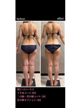トータルビューティー ミミ(Total Beauty mimi)/