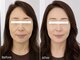 ル シェルシェ 銀座の写真/東洋医学で健やかに美しく!鍼灸と最新機器を組み合わせたオーダーメイドでオンリーワンの施術です。