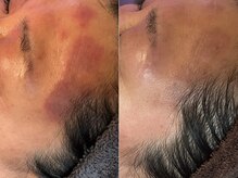 アーブル(Agreable)の雰囲気（どこに原因があるのかを一緒に探すお手伝いをさせていただきます）