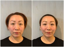 サロンマニア(SALON MANIA)/6回目の比較です