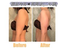 サロンドプレマージュ(Salon de Premage)