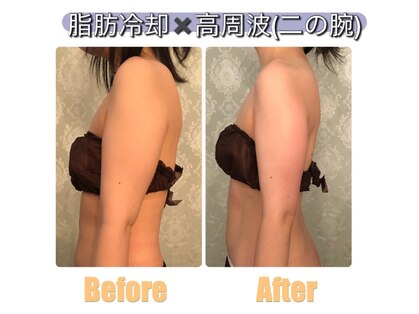 サロンドプレマージュ(Salon de Premage)の写真