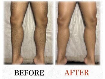 メンズブリリアンス/大人気★両脚全体ＷＡＸ★