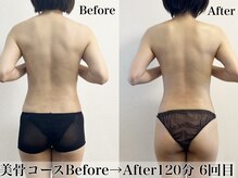 アトレセカンドボディ(Attrait second body)/Before→After【6回目】大阪痩身