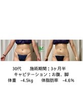 リシャイン(Reshine)/ブライダルダイエット