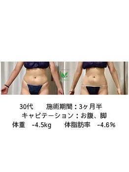 リシャイン(Reshine)/ブライダルダイエット