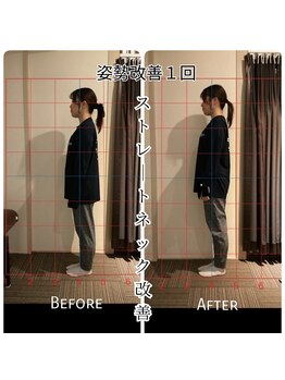 リバイブ 自由が丘店(REVIVE)/姿勢改善1回