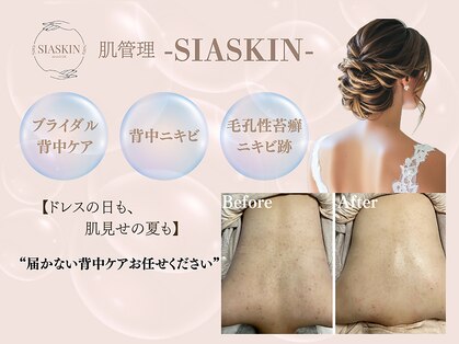 シアスキン(SIASKIN)の写真