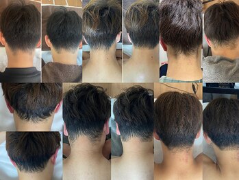 グラフ(GRaph)の写真/韓国で流行men'sえりあし脱毛「美容院帰りのえりあし」がずっと続く!後ろ姿のかっこよさが続くえりあし脱毛