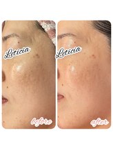 レティシア(Leticia)/◇ララピール◇