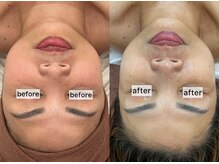 フローレンス(Florence)/50代○○さんの変化