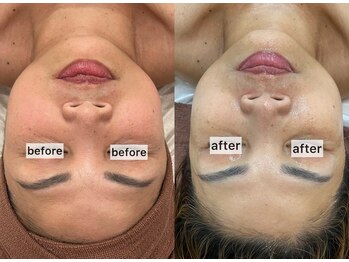 フローレンス(Florence)/50代○○さんの変化