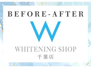 ホワイトニングショップ 千葉店/一般人も歯が命★ホワイトニング