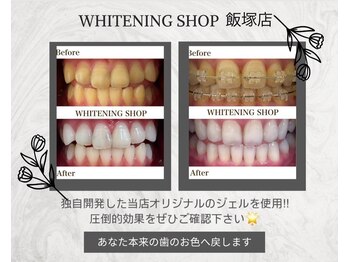 ホワイトニングショップ 飯塚店/ビフォーアフター