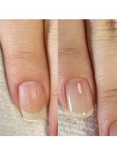 シュシュ(shou shou)/自爪育成